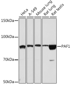 Western blot analysis of various lysates using PAF1 Rabbit mAb at 1:1000 dilution.|Secondary antibody: HRP-conjugated Goat anti-Rabbit IgG (H+L) at 1:10000 dilution.|Lysates/proteins: 25μg per lane.|Blocking buffer: 3% nonfat dry milk in TBST.|Detection: ECL Basic Kit.|Exposure time: 90s.