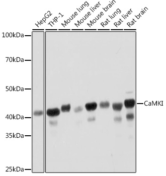 Western blot analysis of various lysates using CaMKI Rabbit mAb at 1:1000 dilution.|Secondary antibody: HRP-conjugated Goat anti-Rabbit IgG (H+L) at 1:10000 dilution.|Lysates/proteins: 25μg per lane.|Blocking buffer: 3% nonfat dry milk in TBST.|Detection: ECL Basic Kit.|Exposure time: 1min.