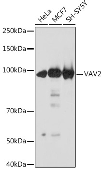 Western blot analysis of various lysates using VAV2 Rabbit mAb (A3548) at 1:1000 dilution.|Secondary antibody: HRP-conjugated Goat anti-Rabbit IgG (H+L) (AS014) at 1:10000 dilution.|Lysates/proteins: 25μg per lane.|Blocking buffer: 3% nonfat dry milk in TBST.|Detection: ECL Basic Kit (RM00020).|Exposure time: 10s.