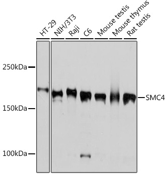 Western blot analysis of various lysates using SMC4 Rabbit mAb at 1:1000 dilution.|Secondary antibody: HRP-conjugated Goat anti-Rabbit IgG (H+L) at 1:10000 dilution.|Lysates/proteins: 25μg per lane.|Blocking buffer: 3% nonfat dry milk in TBST.|Detection: ECL Basic Kit.|Exposure time: 1s.