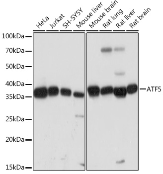 Western blot analysis of various lysates using ATF5 Rabbit mAb at 1:1000 dilution.|Secondary antibody: HRP-conjugated Goat anti-Rabbit IgG (H+L) at 1:10000 dilution.|Lysates/proteins: 25μg per lane.|Blocking buffer: 3% nonfat dry milk in TBST.|Detection: ECL Basic Kit.|Exposure time: 3s.