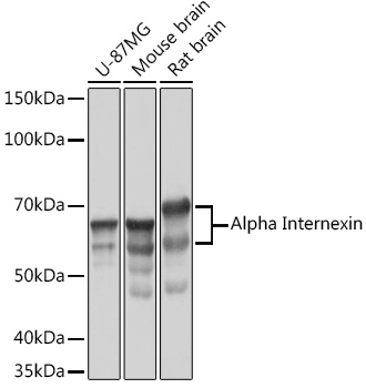 Western blot analysis of various lysates using Alpha Internexin Rabbit mAb at 1:1000 dilution.|Secondary antibody: HRP-conjugated Goat anti-Rabbit IgG (H+L) at 1:10000 dilution.|Lysates/proteins: 25μg per lane.|Blocking buffer: 3% nonfat dry milk in TBST.|Detection: ECL Basic Kit.|Exposure time: 5s.