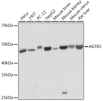 Western blot analysis of various lysates using AGTR2 Rabbit mAb at 1:1000 dilution.|Secondary antibody: HRP-conjugated Goat anti-Rabbit IgG (H+L) at 1:10000 dilution.|Lysates/proteins: 25μg per lane.|Blocking buffer: 3% nonfat dry milk in TBST.|Detection: ECL Basic Kit.|Exposure time: 1min.