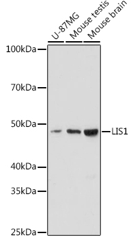 Western blot analysis of various lysates using LIS1 Rabbit mAb at 1:1000 dilution.|Secondary antibody: HRP-conjugated Goat anti-Rabbit IgG (H+L) at 1:10000 dilution.|Lysates/proteins: 25μg per lane.|Blocking buffer: 3% nonfat dry milk in TBST.|Detection: ECL Enhanced Kit.|Exposure time: 180s.