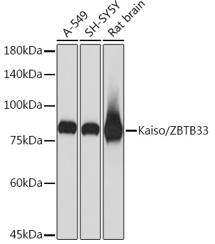 Western blot analysis of various lysates using Kaiso/ZBTB33 Rabbit mAb at 1:1000 dilution.|Secondary antibody: HRP-conjugated Goat anti-Rabbit IgG (H+L) at 1:10000 dilution.|Lysates/proteins: 25μg per lane.|Blocking buffer: 3% nonfat dry milk in TBST.|Detection: ECL Basic Kit.|Exposure time: 1s.