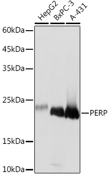 Western blot analysis of various lysates using PERP Rabbit mAb at 1:1000 dilution.|Secondary antibody: HRP-conjugated Goat anti-Rabbit IgG (H+L) at 1:10000 dilution.|Lysates/proteins: 25μg per lane.|Blocking buffer: 3% nonfat dry milk in TBST.|Detection: ECL Basic Kit.|Exposure time: 1s.