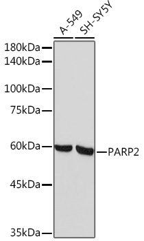 Western blot analysis of various lysates using PARP2 Rabbit mAb at 1:1000 dilution.|Secondary antibody: HRP-conjugated Goat anti-Rabbit IgG (H+L) at 1:10000 dilution.|Lysates/proteins: 25μg per lane.|Blocking buffer: 3% nonfat dry milk in TBST.|Detection: ECL Basic Kit.|Exposure time: 60s.