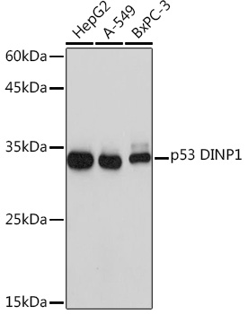 Western blot analysis of various lysates using p53 DINP1 Rabbit mAb at 1:1000 dilution.|Secondary antibody: HRP-conjugated Goat anti-Rabbit IgG (H+L) at 1:10000 dilution.|Lysates/proteins: 25μg per lane.|Blocking buffer: 3% nonfat dry milk in TBST.|Detection: ECL Basic Kit.|Exposure time: 1s.