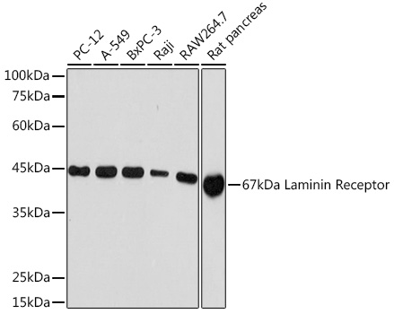 Western blot analysis of various lysates using 67kDa Laminin Receptor Rabbit mAb (A5968) at 1:1000 dilution.|Secondary antibody: HRP-conjugated Goat anti-Rabbit IgG (H+L) (AS014) at 1:10000 dilution.|Lysates/proteins: 25μg per lane.|Blocking buffer: 3% nonfat dry milk in TBST.|Detection: ECL Basic Kit (RM00020).|Exposure time: 10s.