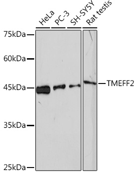 Western blot analysis of various lysates using TMEFF2 Rabbit mAb (A4116) at 1:1000 dilution.|Secondary antibody: HRP-conjugated Goat anti-Rabbit IgG (H+L) (AS014) at 1:10000 dilution.|Lysates/proteins: 25μg per lane.|Blocking buffer: 3% nonfat dry milk in TBST.|Detection: ECL Enhanced Kit (RM00021).|Exposure time: 180s.