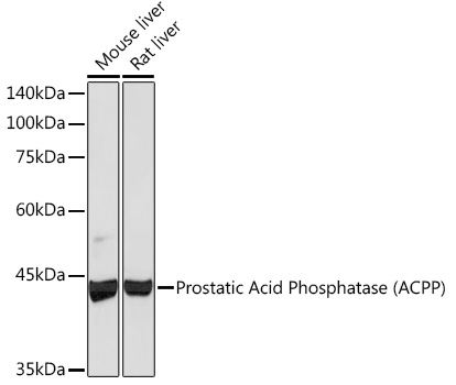 Western blot analysis of various lysates using Prostatic Acid Phosphatase (PAP/ACPP) Rabbit mAb at 1:1000 dilution.|Secondary antibody: HRP-conjugated Goat anti-Rabbit IgG (H+L) at 1:10000 dilution.|Lysates/proteins: 25μg per lane.|Blocking buffer: 3% nonfat dry milk in TBST.|Detection: ECL Basic Kit.|Exposure time: 180s.