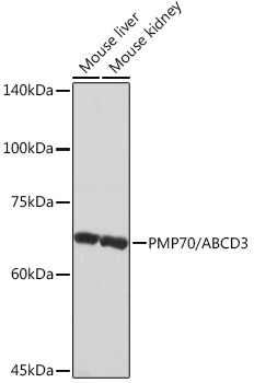 Western blot analysis of various lysates using PMP70/ABCD3 Rabbit mAb at 1:1000 dilution.|Secondary antibody: HRP-conjugated Goat anti-Rabbit IgG (H+L) at 1:10000 dilution.|Lysates/proteins: 25μg per lane.|Blocking buffer: 3% nonfat dry milk in TBST.|Detection: ECL Basic Kit.|Exposure time: 10s.