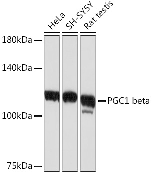 Western blot analysis of various lysates using PGC1 beta Rabbit mAb at 1:1000 dilution.|Secondary antibody: HRP-conjugated Goat anti-Rabbit IgG (H+L) at 1:10000 dilution.|Lysates/proteins: 25μg per lane.|Blocking buffer: 3% nonfat dry milk in TBST.|Detection: ECL Basic Kit.|Exposure time: 10s.