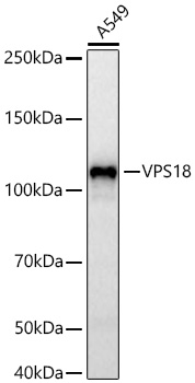 Western blot analysis of lysates from A549 cells using VPS18 Rabbit mAb (A17563) at 1:1000 dilution incubated overnight at 4℃.|Secondary antibody: HRP-conjugated Goat anti-Rabbit IgG (H+L) (AS014) at 1:10000 dilution.|Lysates/proteins: 25 μg per lane.|Blocking buffer: 3% nonfat dry milk in TBST.|Detection: ECL Basic Kit (RM00020).|Exposure time: 20 s.