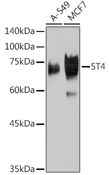 Western blot analysis of various lysates using 5T4 Rabbit mAb (A19541) at 1:1000 dilution.|Secondary antibody: HRP-conjugated Goat anti-Rabbit IgG (H+L) (AS014) at 1:10000 dilution.|Lysates/proteins: 25μg per lane.|Blocking buffer: 3% nonfat dry milk in TBST.|Detection: ECL Basic Kit (RM00020).|Exposure time: 90s.