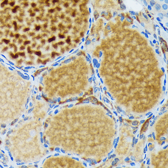 Immunohistochemistry analysis of paraffin-embedded Rat thyroid using Thyroid Peroxidase Rabbit mAb (A19547) at dilution of 1:100 (40x lens). Microwave antigen retrieval performed with 0.01M Tris/EDTA Buffer (pH 9.0) prior to IHC staining.
