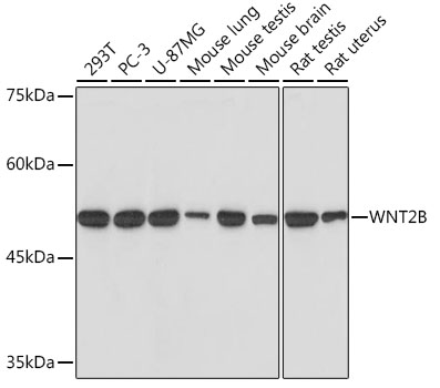 Western blot analysis of various lysates using WNT2B Rabbit mAb (A19554) at 1:1000 dilution.|Secondary antibody: HRP-conjugated Goat anti-Rabbit IgG (H+L) (AS014) at 1:10000 dilution.|Lysates/proteins: 25μg per lane.|Blocking buffer: 3% nonfat dry milk in TBST.|Detection: ECL Basic Kit (RM00020).|Exposure time: 10s.