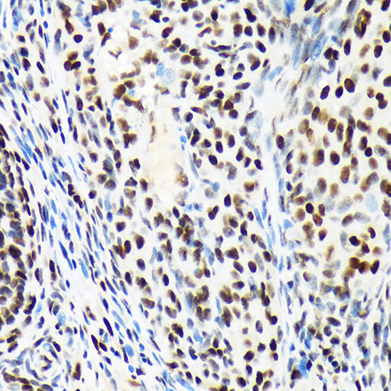 Immunohistochemistry analysis of paraffin-embedded Rat ovary using ARID1A Rabbit mAb at dilution of 1:100 (40x lens). Microwave antigen retrieval performed with 0.01M Tris/EDTA Buffer (pH 9.0) prior to IHC staining.