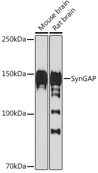 Western blot analysis of various lysates using SynGAP Rabbit mAb at 1:1000 dilution.|Secondary antibody: HRP-conjugated Goat anti-Rabbit IgG (H+L) at 1:10000 dilution.|Lysates/proteins: 25μg per lane.|Blocking buffer: 3% nonfat dry milk in TBST.|Detection: ECL Basic Kit.|Exposure time: 60s.