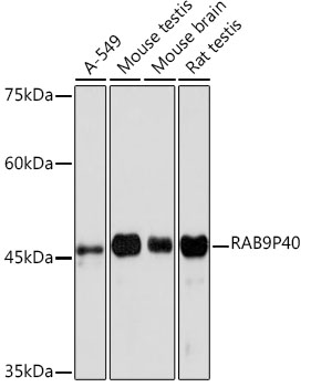 Western blot analysis of various lysates using RAB9RAB9P40 Rabbit mAb at 1:1000 dilution.|Secondary antibody: HRP-conjugated Goat anti-Rabbit IgG (H+L) at 1:10000 dilution.|Lysates/proteins: 25μg per lane.|Blocking buffer: 3% nonfat dry milk in TBST.|Detection: ECL Basic Kit.|Exposure time: 180s.