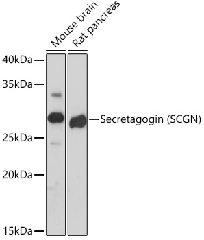 Western blot analysis of various lysates using Secretagogin (SCGN) Rabbit mAb at 1:1000 dilution.|Secondary antibody: HRP-conjugated Goat anti-Rabbit IgG (H+L) at 1:10000 dilution.|Lysates/proteins: 25μg per lane.|Blocking buffer: 3% nonfat dry milk in TBST.|Detection: ECL Basic Kit.|Exposure time: 180s.