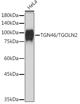 Western blot analysis of lysates from HeLa cells, using TGN46/TGOLN2 Rabbit mAb (A19618) at 1:1000 dilution.|Secondary antibody: HRP-conjugated Goat anti-Rabbit IgG (H+L) (AS014) at 1:10000 dilution.|Lysates/proteins: 25μg per lane.|Blocking buffer: 3% nonfat dry milk in TBST.|Detection: ECL Basic Kit (RM00020).|Exposure time: 1s.