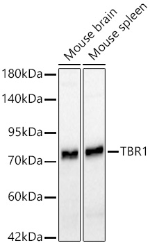 Western blot analysis of various lysates using TBR1 Rabbit mAb at 1:1000 dilution incubated overnight at 4℃.|Secondary antibody: HRP-conjugated Goat anti-Rabbit IgG (H+L) at 1:10000 dilution.|Lysates/proteins: 25 μg per lane.|Blocking buffer: 3% nonfat dry milk in TBST.|Detection: ECL Basic Kit.|Exposure time: 45s.