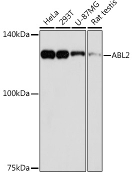 Western blot analysis of various lysates using ABL2 Rabbit mAb at 1:1000 dilution.|Secondary antibody: HRP-conjugated Goat anti-Rabbit IgG (H+L) at 1:10000 dilution.|Lysates/proteins: 25μg per lane.|Blocking buffer: 3% nonfat dry milk in TBST.|Detection: ECL Basic Kit.|Exposure time: 90s.
