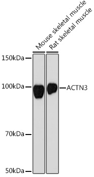 Western blot analysis of various lysates using ACTN3 Rabbit mAb at 1:1000 dilution.|Secondary antibody: HRP-conjugated Goat anti-Rabbit IgG (H+L) at 1:10000 dilution.|Lysates/proteins: 25μg per lane.|Blocking buffer: 3% nonfat dry milk in TBST.|Detection: ECL Basic Kit.|Exposure time: 90s.
