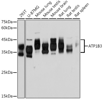 Western blot analysis of various lysates using ATP1B3 Rabbit mAb at 1:1000 dilution.|Secondary antibody: HRP-conjugated Goat anti-Rabbit IgG (H+L) at 1:10000 dilution.|Lysates/proteins: 25μg per lane.|Blocking buffer: 3% nonfat dry milk in TBST.|Detection: ECL Basic Kit.|Exposure time: 60s.