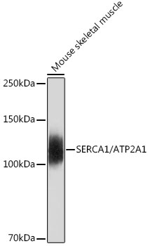 Western blot analysis of lysates from Mouse skeletal muscle, using SERCA1/ATP2A1 Rabbit mAb at 1:500 dilution.|Secondary antibody: HRP-conjugated Goat anti-Rabbit IgG (H+L) at 1:10000 dilution.|Lysates/proteins: 25μg per lane.|Blocking buffer: 3% nonfat dry milk in TBST.|Detection: ECL Basic Kit.|Exposure time: 30s.