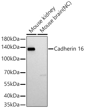 Western blot analysis of various lysates using Cadherin 16 Rabbit mAb at 1:1000 dilution incubated at room temperature for 1.5 hours.|Secondary antibody: HRP-conjugated Goat anti-Rabbit IgG (H+L) at 1:10000 dilution.|Lysates/proteins: 25 μg per lane.|Blocking buffer: 3% nonfat dry milk in TBST.|Detection: ECL Basic Kit.|Negative control (NC): Mouse brain.|Exposure time: 5 s.