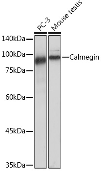 Western blot analysis of various lysates, using Calmegin Rabbit mAb at 1:1000 dilution.|Secondary antibody: HRP-conjugated Goat anti-Rabbit IgG (H+L) at 1:10000 dilution.|Lysates/proteins: 25μg per lane.|Blocking buffer: 3% nonfat dry milk in TBST.|Detection: ECL Basic Kit.|Exposure time: 10s.