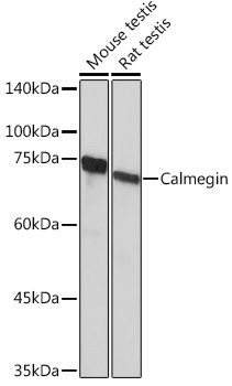 Western blot analysis of various lysates using Calmegin Rabbit mAb at 1:1000 dilution.|Secondary antibody: HRP-conjugated Goat anti-Rabbit IgG (H+L) at 1:10000 dilution.|Lysates/proteins: 25μg per lane.|Blocking buffer: 3% nonfat dry milk in TBST.|Detection: ECL Basic Kit.|Exposure time: 10s.