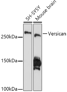 Western blot analysis of various lysates using Versican Rabbit mAb (A19655) at 1:1000 dilution.|Secondary antibody: HRP-conjugated Goat anti-Rabbit IgG (H+L) (AS014) at 1:10000 dilution.|Lysates/proteins: 25μg per lane.|Blocking buffer: 3% nonfat dry milk in TBST.|Detection: ECL Enhanced Kit (RM00021).|Exposure time: 180s.