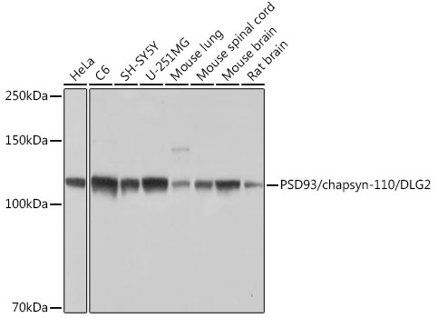 Western blot analysis of various lysates using PSD93/chapsyn-110/DLG2 Rabbit mAb at 1:1000 dilution.|Secondary antibody: HRP-conjugated Goat anti-Rabbit IgG (H+L) at 1:10000 dilution.|Lysates/proteins: 25μg per lane.|Blocking buffer: 3% nonfat dry milk in TBST.|Detection: ECL Basic Kit.|Exposure time: 1s.