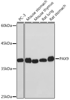 Western blot analysis of various lysates using PAX9 Rabbit mAb at 1:1000 dilution.|Secondary antibody: HRP-conjugated Goat anti-Rabbit IgG (H+L) at 1:10000 dilution.|Lysates/proteins: 25μg per lane.|Blocking buffer: 3% nonfat dry milk in TBST.|Detection: ECL Basic Kit.|Exposure time: 10s.