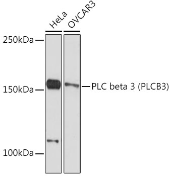 Western blot analysis of various lysates using PLC beta 3 (PLCB30) Rabbit mAb at 1:1000 dilution.|Secondary antibody: HRP-conjugated Goat anti-Rabbit IgG (H+L) at 1:10000 dilution.|Lysates/proteins: 25μg per lane.|Blocking buffer: 3% nonfat dry milk in TBST.|Detection: ECL Basic Kit.|Exposure time: 90s.