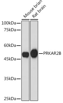 Western blot analysis of various lysates using PRKAR2B Rabbit mAb at 1:1000 dilution.|Secondary antibody: HRP-conjugated Goat anti-Rabbit IgG (H+L) at 1:10000 dilution.|Lysates/proteins: 25μg per lane.|Blocking buffer: 3% nonfat dry milk in TBST.|Detection: ECL Basic Kit.|Exposure time: 180s.