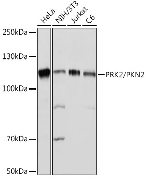Western blot analysis of various lysates using PRK2/PRK2/PKN2 Rabbit mAb at 1:1000 dilution.|Secondary antibody: HRP-conjugated Goat anti-Rabbit IgG (H+L) at 1:10000 dilution.|Lysates/proteins: 25μg per lane.|Blocking buffer: 3% nonfat dry milk in TBST.|Detection: ECL Basic Kit.|Exposure time: 1s.