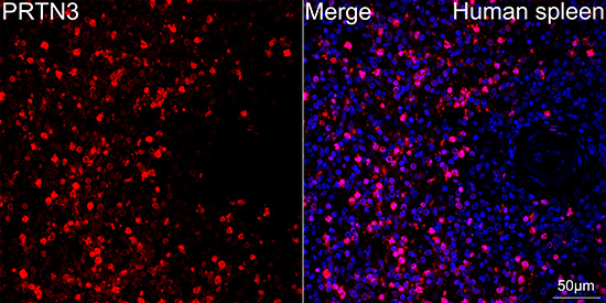 Confocal imaging of paraffin-embedded Human spleen using Proteinase 3/PR3 Rabbit mAb followed by a further incubation with Cy3 Goat Anti-Rabbit IgG (H+L) (Red). DAPI was used for nuclear staining (Blue). Objective: 40x. Perform high pressure antigen retrieval with 0.01 M citrate buffer (pH 6.0) prior to IF staining.
