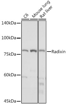 Western blot analysis of various lysates using Radixin Rabbit mAb at 1:1000 dilution.|Secondary antibody: HRP-conjugated Goat anti-Rabbit IgG (H+L) at 1:10000 dilution.|Lysates/proteins: 25μg per lane.|Blocking buffer: 3% nonfat dry milk in TBST.|Detection: ECL Basic Kit.|Exposure time: 1s.