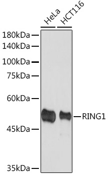 Western blot analysis of various lysates using RING1A Rabbit mAb at 1:1000 dilution.|Secondary antibody: HRP-conjugated Goat anti-Rabbit IgG (H+L) at 1:10000 dilution.|Lysates/proteins: 25μg per lane.|Blocking buffer: 3% nonfat dry milk in TBST.|Detection: ECL Basic Kit.|Exposure time: 90s.