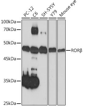 Western blot analysis of various lysates using RORβ Rabbit mAb at 1:1000 dilution.|Secondary antibody: HRP-conjugated Goat anti-Rabbit IgG (H+L) at 1:10000 dilution.|Lysates/proteins: 25μg per lane.|Blocking buffer: 3% nonfat dry milk in TBST.|Detection: ECL Basic Kit.|Exposure time: 60s.