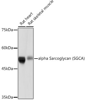 Western blot analysis of various lysates using alpha Sarcoglycan (SGCA) (SGCA) Rabbit mAb at 1:500 dilution.|Secondary antibody: HRP-conjugated Goat anti-Rabbit IgG (H+L) at 1:10000 dilution.|Lysates/proteins: 25μg per lane.|Blocking buffer: 3% nonfat dry milk in TBST.|Detection: ECL Basic Kit.|Exposure time: 10s.