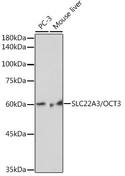 Western blot analysis of various lysates using SLC22A3/OCT3 Rabbit mAb at 1:1000 dilution.|Secondary antibody: HRP-conjugated Goat anti-Rabbit IgG (H+L) at 1:10000 dilution.|Lysates/proteins: 25μg per lane.|Blocking buffer: 3% nonfat dry milk in TBST.|Detection: ECL Basic Kit.|Exposure time: 5s.