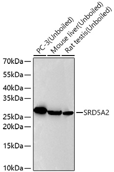Western blot analysis of various lysates using SRD5A2 Rabbit mAb at 1:7000 dilution incubated overnight at 4℃.|Secondary antibody: HRP-conjugated Goat anti-Rabbit IgG (H+L) at 1:10000 dilution.|Lysates/proteins: 25 μg per lane.|Blocking buffer: 3% nonfat dry milk in TBST.|Detection: ECL Basic Kit.|Exposure time: 45 s.
