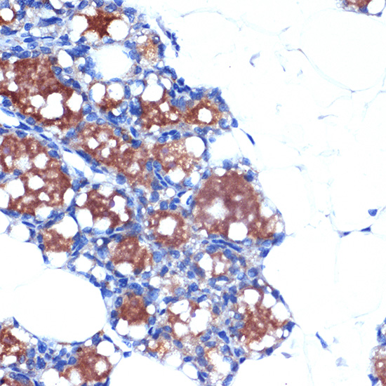 Immunohistochemistry analysis of paraffin-embedded Rat brown adipose using UCP1+UCP3 Rabbit mAb (A19526) at dilution of 1:100 (40x lens). Microwave antigen retrieval performed with 0.01M Tris/EDTA Buffer (pH 9.0) prior to IHC staining.