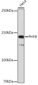 Western blot analysis of lysates from HeLa cells, using PHF8 Rabbit mAb at 1:1000 dilution.|Secondary antibody: HRP-conjugated Goat anti-Rabbit IgG (H+L) at 1:10000 dilution.|Lysates/proteins: 25μg per lane.|Blocking buffer: 3% nonfat dry milk in TBST.|Detection: ECL Basic Kit.|Exposure time: 30s.