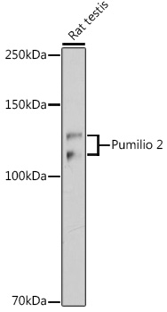 Western blot analysis of lysates from Rat testis, using Pumilio 2 Rabbit mAb at 1:1000 dilution.|Secondary antibody: HRP-conjugated Goat anti-Rabbit IgG (H+L) at 1:10000 dilution.|Lysates/proteins: 25μg per lane.|Blocking buffer: 3% nonfat dry milk in TBST.|Detection: ECL Basic Kit.|Exposure time: 180s.